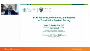 An Image From "ECG Features, Indications, and Results of Conduction System Pacing with Kevin Kwaku, MD"