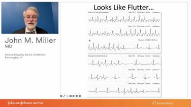 An Image From "Atrial Flutter Soup to Nuts with John Miller, MD"
