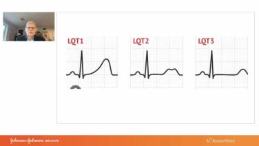 An Image From "Pathogenesis, Diagnoses and Management of the Patient with Polymorphic VT with Melvin Scheinman, MD"
