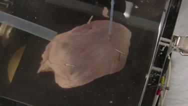 Biophysics of Radiofrequency Energy with the QDOT MICRO™ Catheter -thumbnail