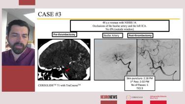 An Image From "CEREGLIDE™ 71 Testimonial and Presentation, Dr. Edgar Samaniego"