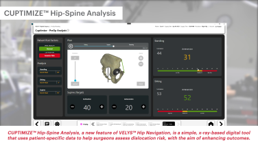 Image from CUPTIMIZE™ Advanced Hip-Spine Analysis & Guidance: Accuracy & Efficiency