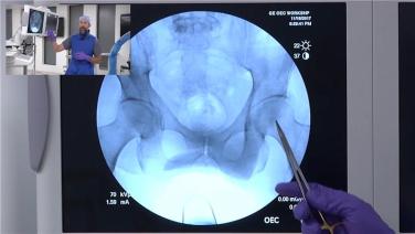 an Xray within Anterior Approach: Patient Positioning w/Fluoroscopy Pre-Operatively