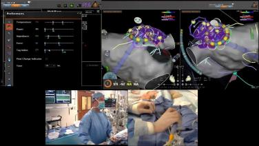 An integrated experience with the VARIPULSE™ Platform