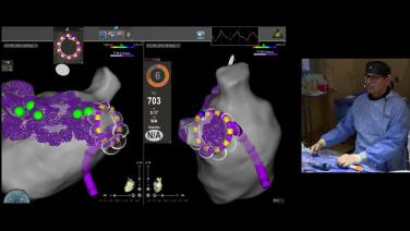 Clinical workflow techniques with the VARIPULSE™ Platform