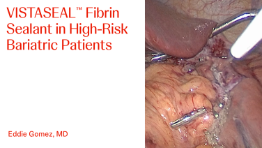 An Image From "VISTASEAL™ Fibrin Sealant in High-Risk Bariatric Patients with Eddie Gomez, MD"