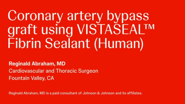 Coronary artery bypass graft using SURGICEL SNoW™ with Faraz Kerendi, MD thumbnail