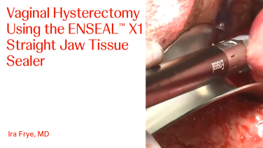 AN Image From "Vaginal Hysterectomy Using the ENSEAL™ X1 Straight Jaw Tissue Sealer with Ira Frye, MD"