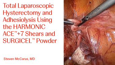 An Image From "Total Laparoscopic Hysterectomy and Adhesiolysis Using the HARMONIC ACE™+7 Shears and SURGICEL™ Powder with Steven McCarus, MD"