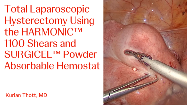 An Image From "Total Laparoscopic Hysterectomy Using the HARMONIC™ 1100 Shears and SURGICEL™ Powder Absorbable Hemostat with Kurian Thott, MD"