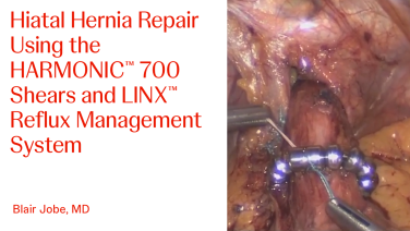 Step-by-Step Demonstration of a Hiatal Hernia Repair with Blair Jobe, MD