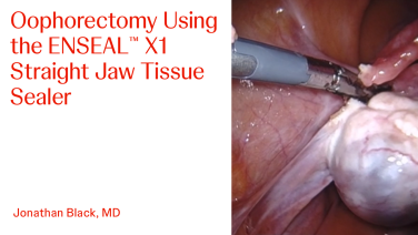 An Image From "Oophorectomy Using the ENSEAL™ X1 Straight Jaw Tissue Sealer with Jonathan Black, MD"