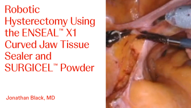 An Image From "Robotic Hysterectomy Using the ENSEAL™ X1 Curved Jaw Tissue Sealer and SURGICEL™ Powder with Jonathan Black, MD"