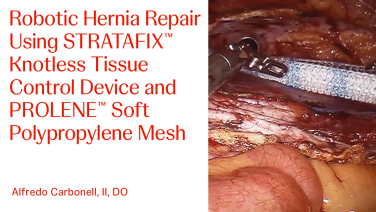 An image of the "Robotic Hernia Repair Using STRATAFIX™ Knotless Tissue Control Device and PROLENE™ Soft Polypropylene Mesh with Alfredo Carbonell, II, DO" video on the JnJInstitute.com website.