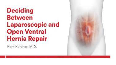 An Image From "Deciding Between a Laparoscopic and Open Ventral Hernia Repair with Kent Kercher, MD"