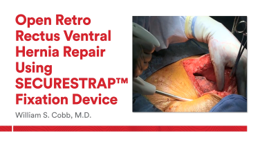 An Image From "Open Retro Rectus Ventral Hernia Repair using SECURESTRAP™ Fixation Device with William Cobb, MD"