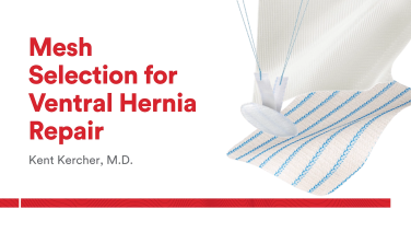 An Image From "Mesh Selection for Ventral Hernia Repair with Kent Kercher, MD"