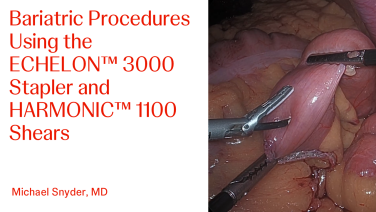 An Image From "Bariatric Procedures Using the ECHELON™ 3000 Stapler and HARMONIC™ 1100 Shears with Michael Snyder, MD"