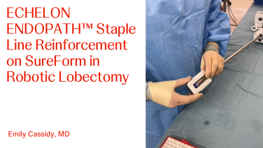 An Image From "ECHELON ENDOPATH™ Staple Line Reinforcement on SureForm in Robotic Lobectomy with Emily Cassidy, MD"
