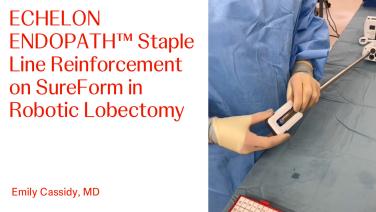 An Image From "One Anastomosis Gastric Bypass (OAGB) with James Dasher, MD and Thomas Walsh, MD"