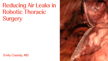 An image from "Reducing Air Leaks in Robotic Thoracic Surgery with Emily Cassidy, MD"