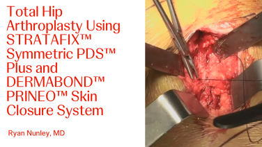 An Image From "Total Hip Arthroplasty Procedure Video with Ryan Nunley, MD"