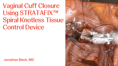 An Image From " Robotic Vaginal Cuff Closure Featuring STRATAFIX™ Spiral Knotless Tissue Control Device with Jonathan D. Black, MD, MPH"
