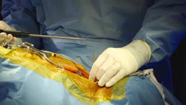 procedure step from Posterior Cervical Spine Procedural Workflow Featuring VELYS Spine with Brandon Lawrence, MD