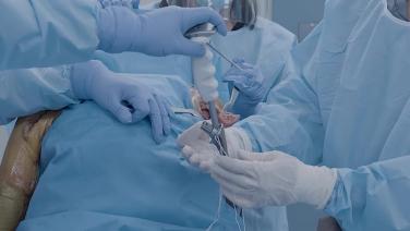 HCPs holding a medical device from Reverse Shoulder Arthroplasty for Fracture Repair: Tuberosity Management and Implant Fixation with Luke Austin, MD