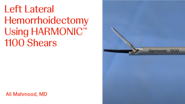 An Image From "Left Lateral Hemorrhoidectomy Using HARMONIC™ 1100 Shears with Ali Mahmood, MD"