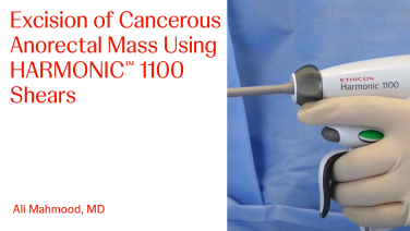 An Image From "Excision of Cancerous Anorectal Mass Using HARMONIC™ 1100 Shears with Ali Mahmood, MD"