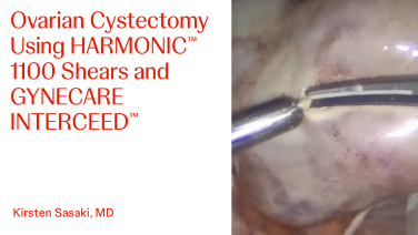 An Image From "Ovarian Cystectomy Using HARMONIC™ 1100 Shears and GYNECARE INTERCEED™ with Kirsten Sasaki, MD "