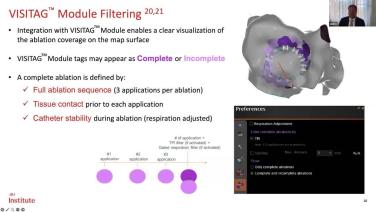 Mastering paroxysmal afib with the VARIPULSE™ Platform with Dr. Dukes