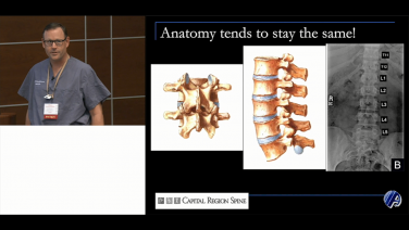Anatomy for Thoracic & Lumbar Pedicle Screws with Jamie Lawrence, MD