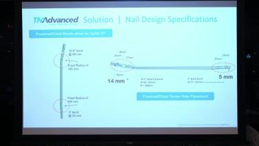 Complex Tibial Shaft Fracture Management with Dr. Christopher Finkemeier