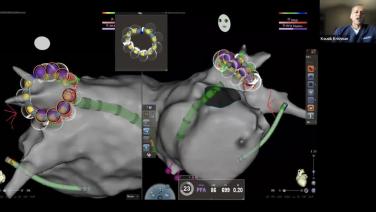 An Image from "VARIPULSE™ Platform Edward Hospital Workflows"