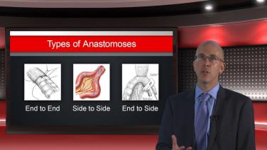 An image from the "Anastomotic Considerations: Module #1 Types of Anastomosis" course on courses.jnjinstitute.com website.