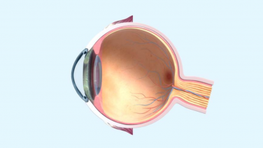 An image of the "Virtual Eye Model" external link.