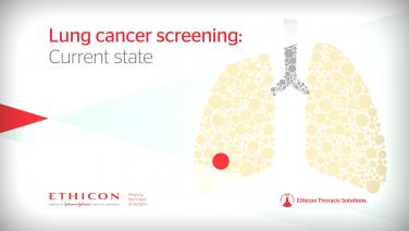 The Current State of Lung Cancer