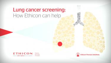 An image of the "How Ethicon can help with Lung Cancer Screening" video.