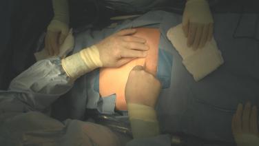 An image of the "Total Abdominal Hysterectomy Procedure with DERMABOND PRINEO 42cm - Thad Denehy, MD (Gynecology)" video.