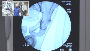AA Demonstration with Joseph M. Schwab, MD - Acetabular X-ray Interpretation