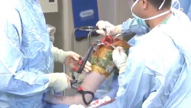 ATTUNE® Knee Surgical Insights, Rotating Platform