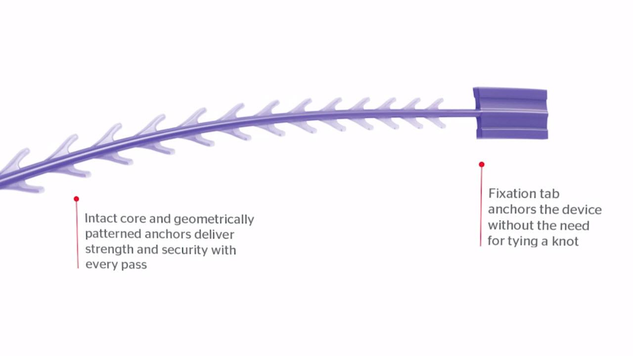An image of the "STRATAFIX Symmetric PDS vs. Traditional Suture & V-Loc™" video.