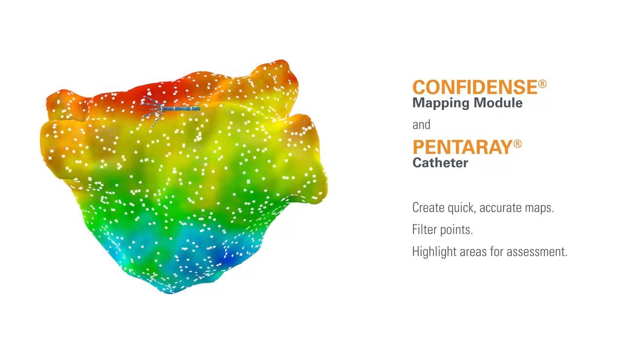 An image from the "CONFIDENSE® Mapping Module & PENTARAY® Catheter for Quick, Accurate Mapping & Voltage Validation" video on the JnJInstitute.com website.