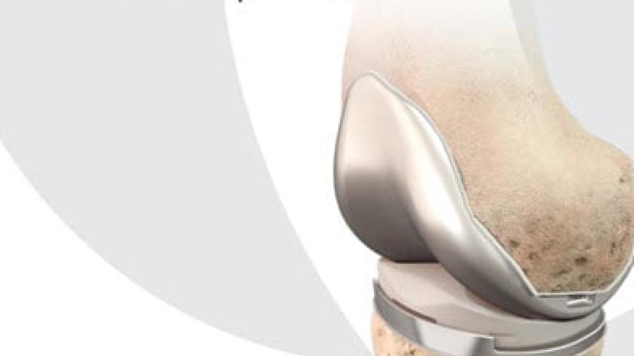 Guidance for Cementing Primary Total Knee Replacements