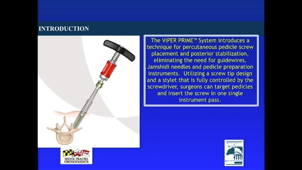 An image from the "Driving Operating Room Efficiency with the VIPER Prime™ System by Steven Ludwig, MD" video on the JnJInstitute.com website.