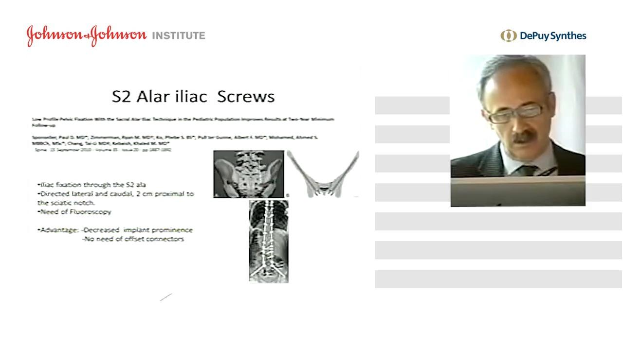 Image from: "Sacro-Pelvic Fixation" on the jnjinstitute.com website