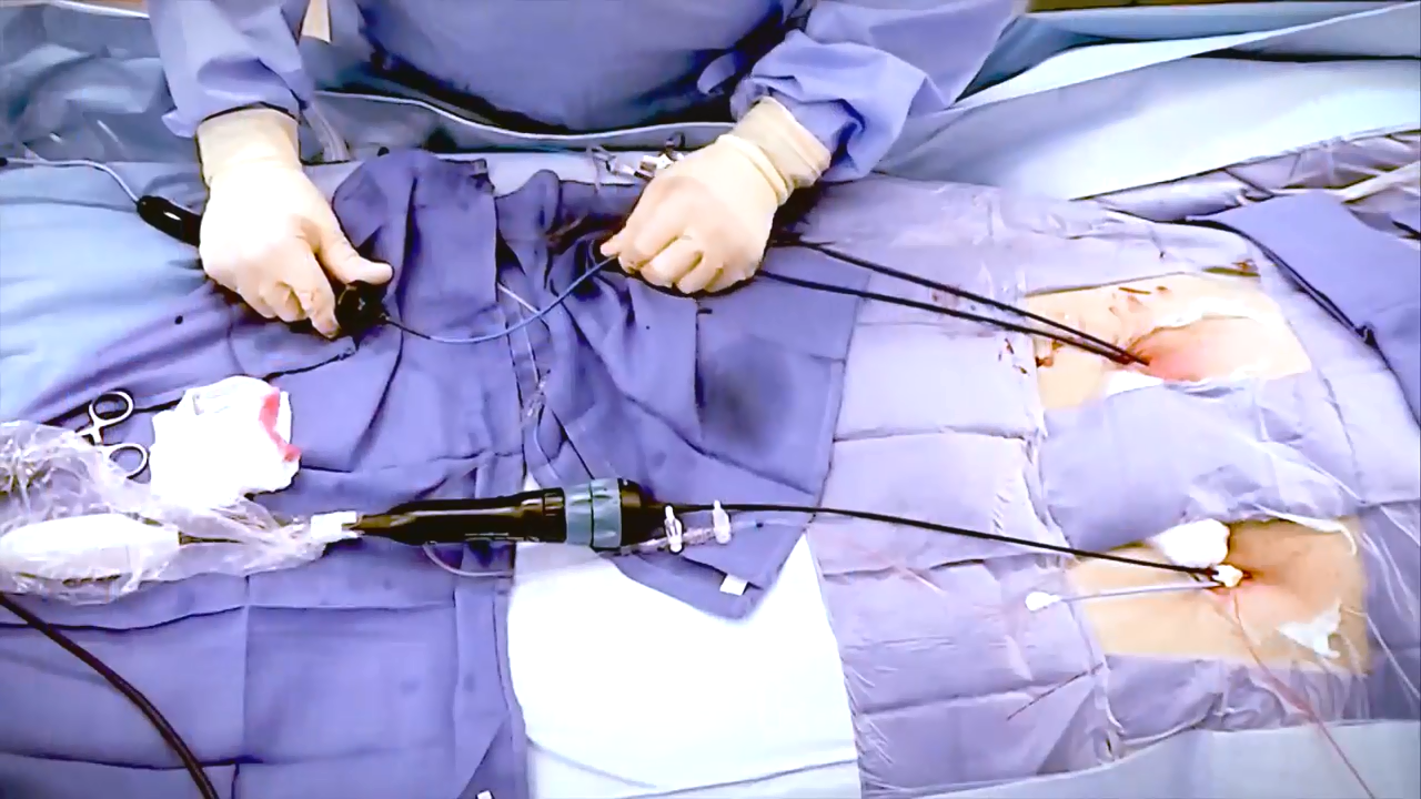 An image of the "Transseptal Puncture Techniques with Rodney Horton, MD" video on the JnJInstitute.com website.