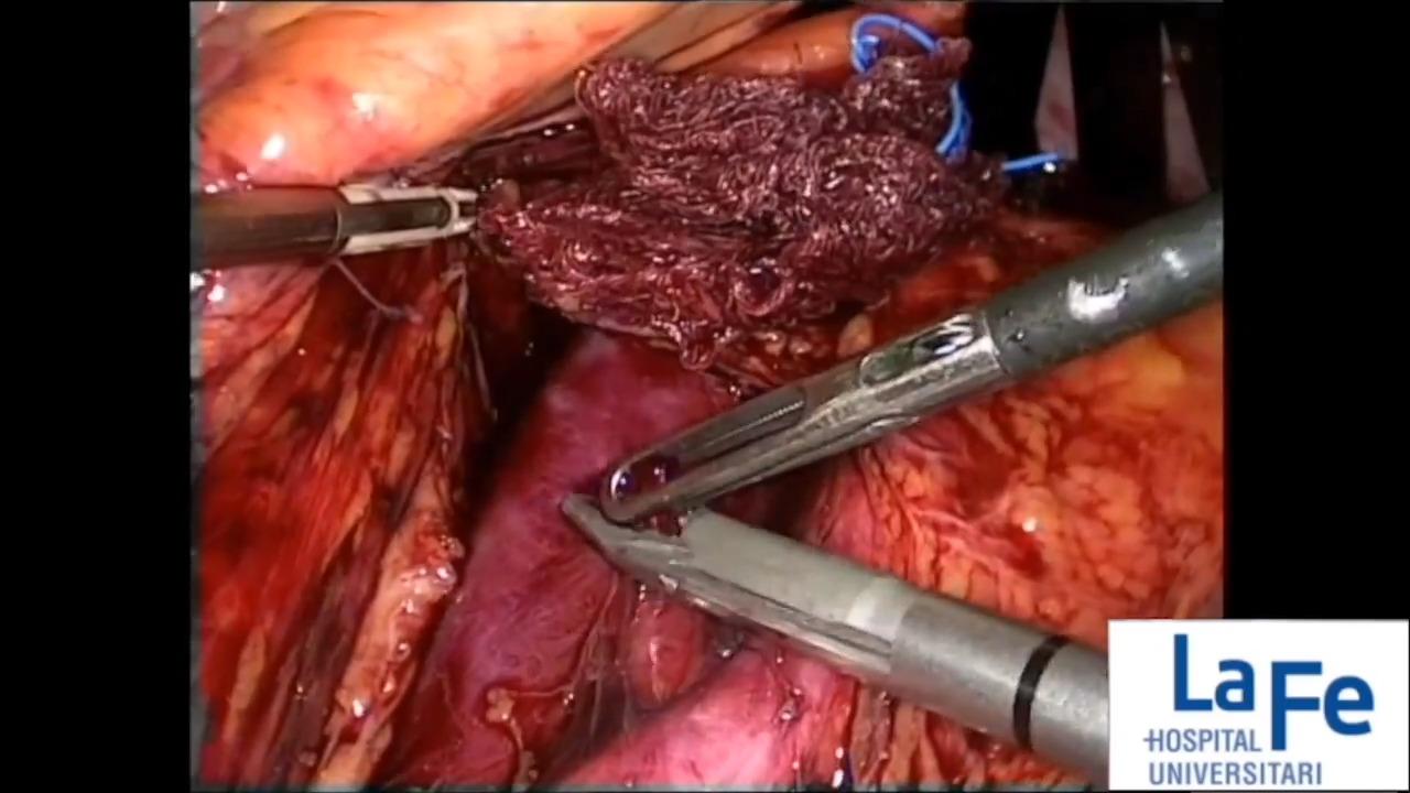 Image from: "Vascular Injuries with Santiago Domingo, MD" on the jnjinstitute.com website